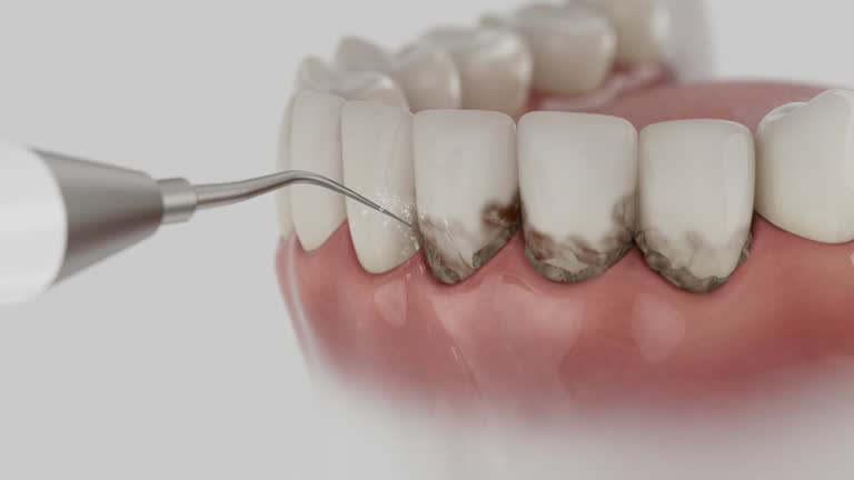 Trusted Tooth Extraction service in Bay City, TX - Dentist Open Now